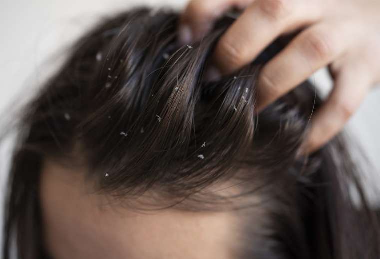 HAIR-TREATMENT-4-760x519